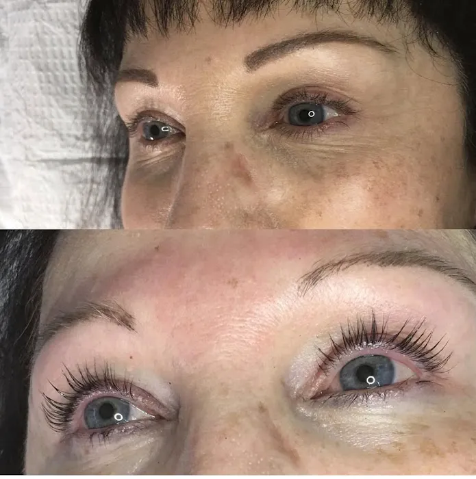 Tacoma Skin Care Picture 5