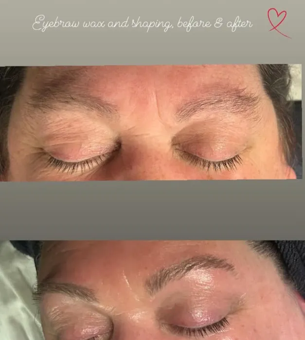 Tacoma Skin Care Picture 8