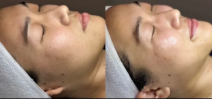 Island Skincare Picture 2