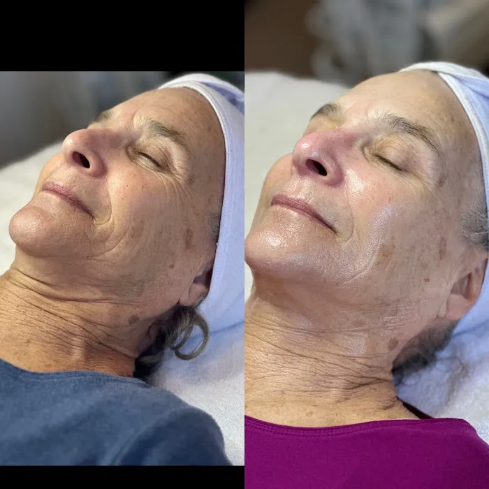 Island Skincare Picture 8