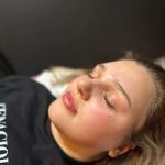 Stronger Skin by Emma