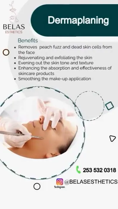 Belas Esthetics Picture 7