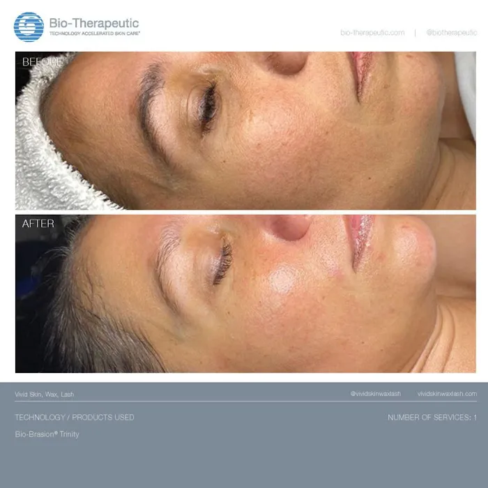 Dawndi's Skin Care Picture 8