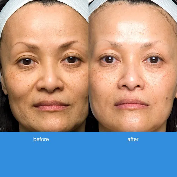 Dawndi's Skin Care Picture 7