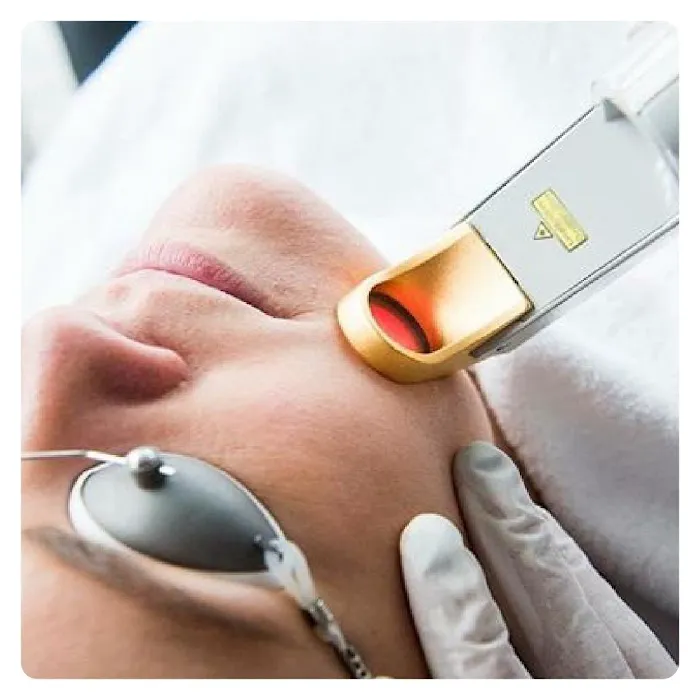 BELLINGHAM BOTOX Picture 5