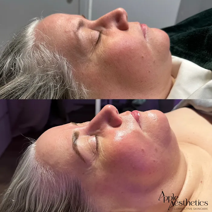 Apple Aesthetics LLC Picture 2