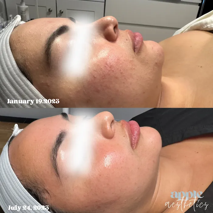 Apple Aesthetics LLC Picture 6