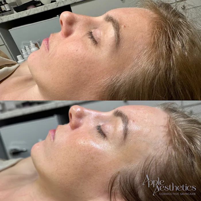 Apple Aesthetics LLC Picture 10