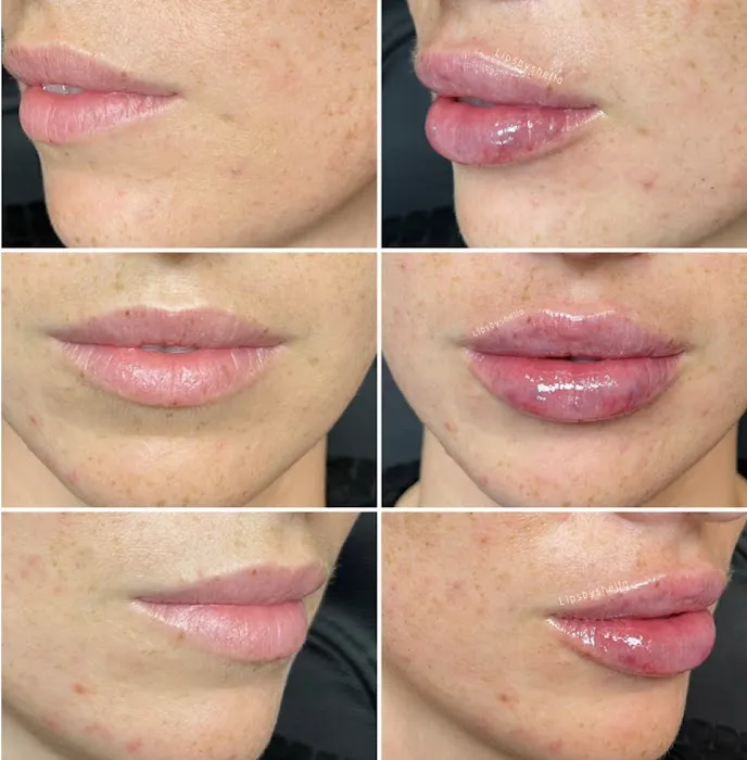 Belle Medical Aesthetics Picture 1