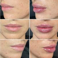 Belle Medical Aesthetics ico