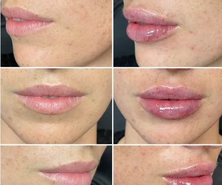 Belle Medical Aesthetics