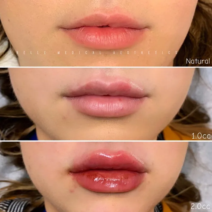 Belle Medical Aesthetics Picture 5