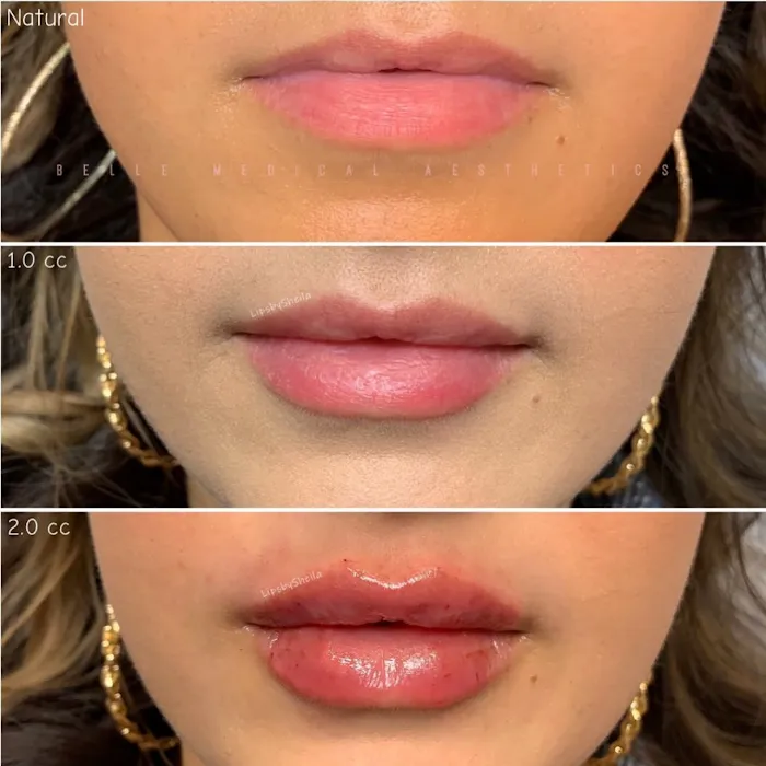 Belle Medical Aesthetics Picture 7