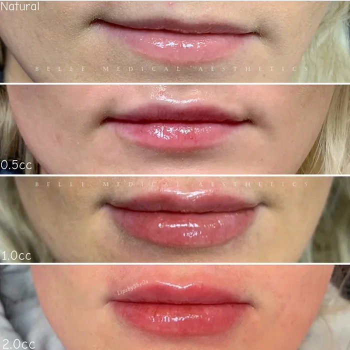 Belle Medical Aesthetics Picture 6