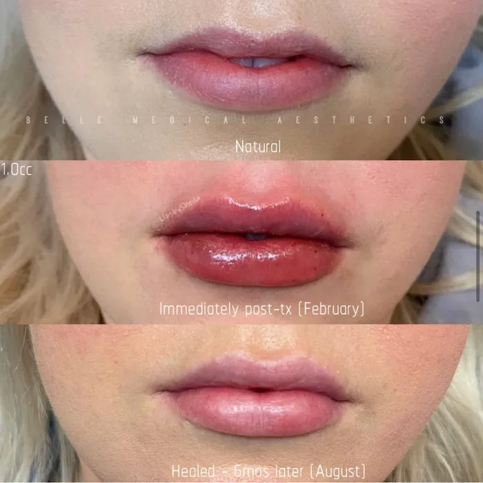 Belle Medical Aesthetics Picture 8