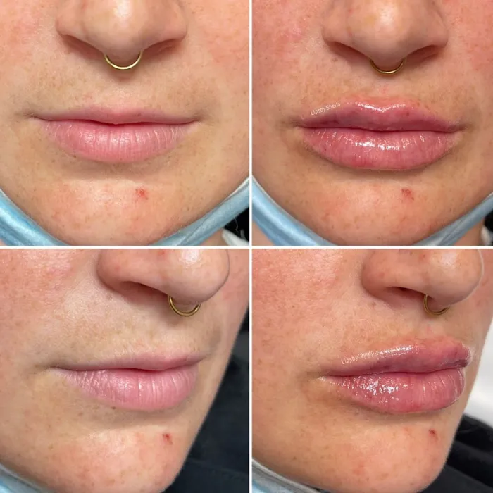 Belle Medical Aesthetics Picture 10