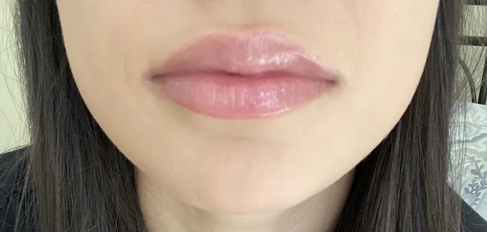 Gig Harbor Aesthetics & Wellness Picture 6