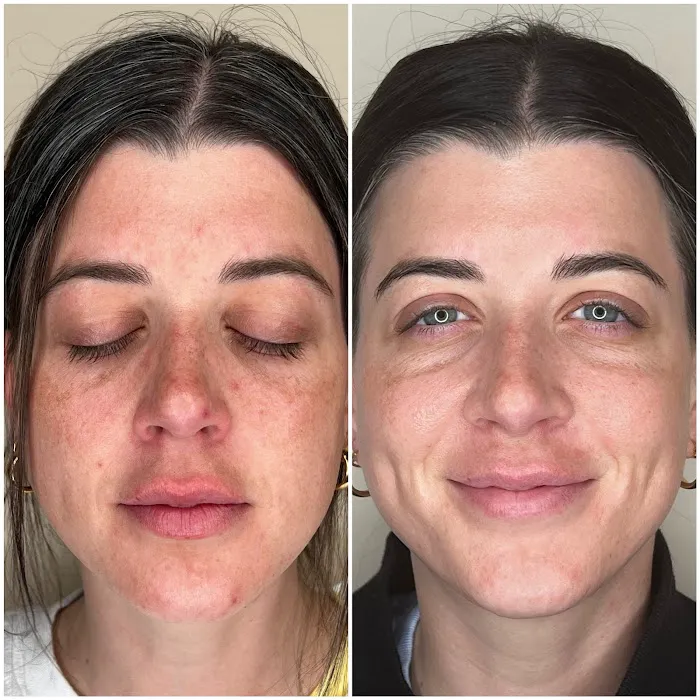 The Olympia Esthetician Picture 6