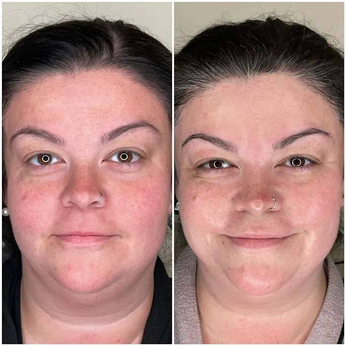 The Olympia Esthetician Picture 7