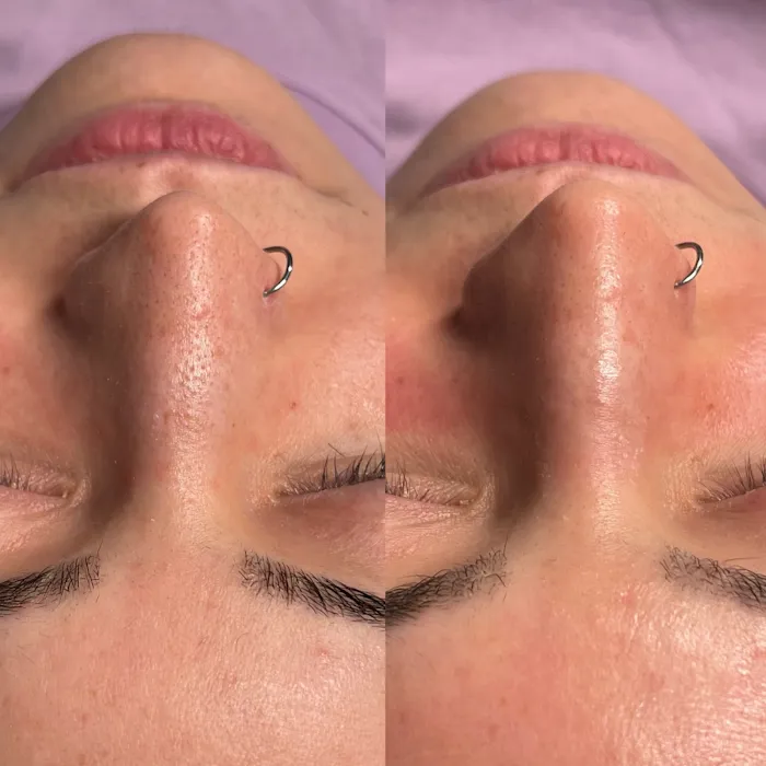 The Olympia Esthetician Picture 10