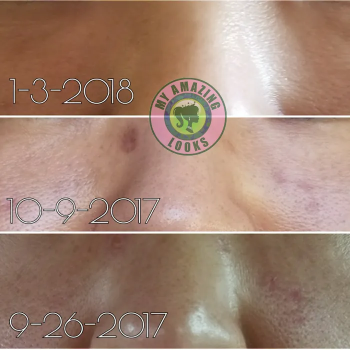 My Amazing Looks Picture 7