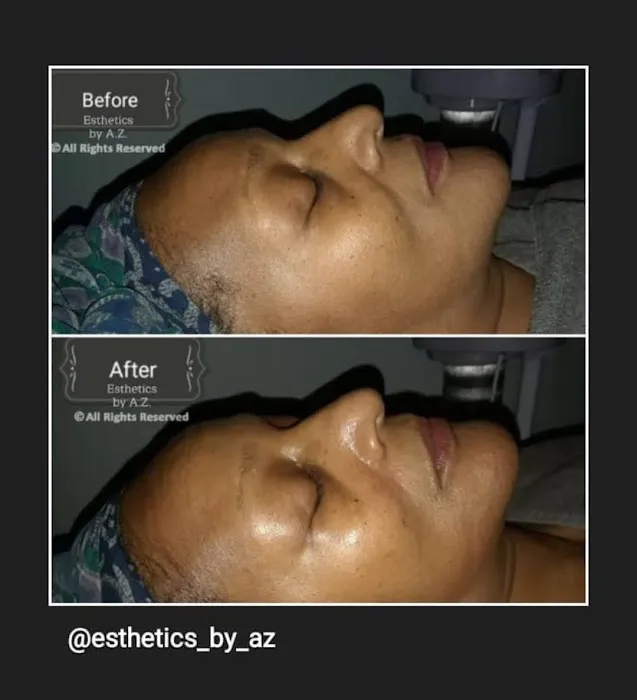 Esthetics by AZ Picture 1