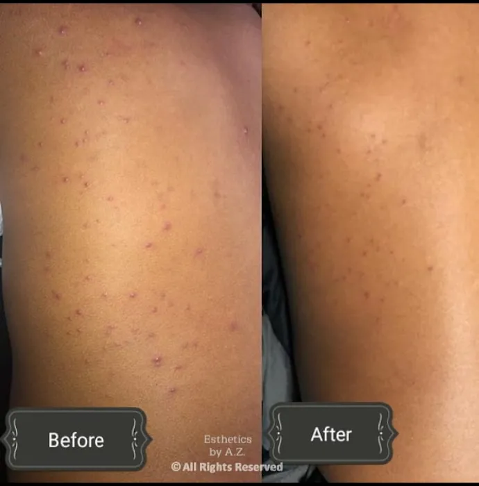 Esthetics by AZ Picture 3