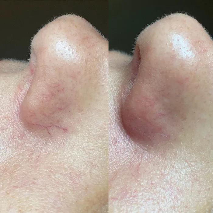 Papaya Skin Bar Picture 2