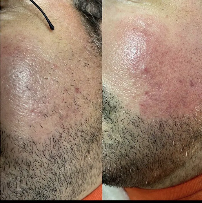 Papaya Skin Bar Picture 1