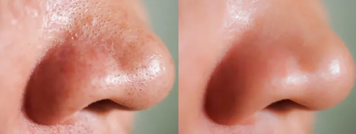 Papaya Skin Bar Picture 5