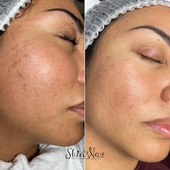 Skin by Naz Picture 6