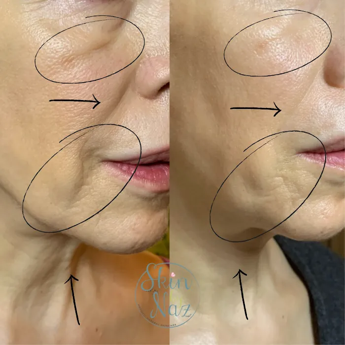 Skin by Naz Picture 5