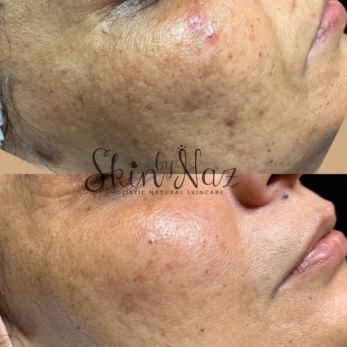 Skin by Naz Picture 7