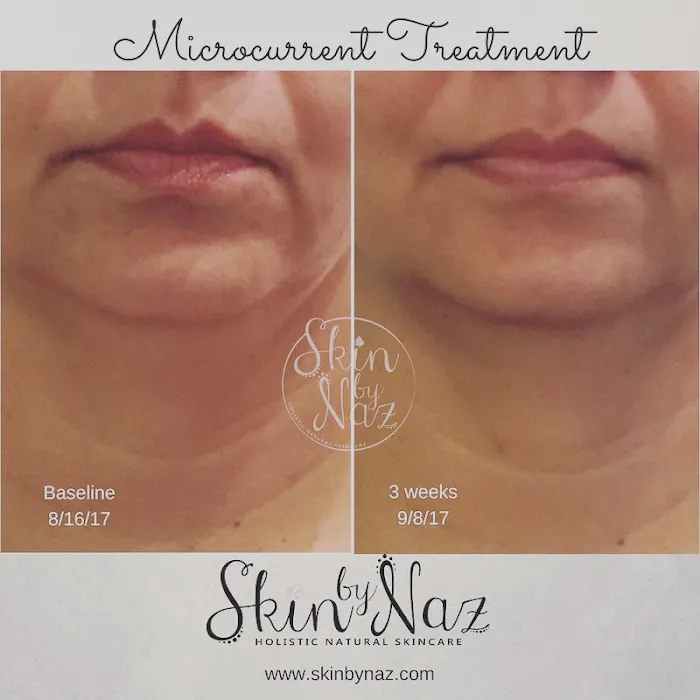 Skin by Naz Picture 10