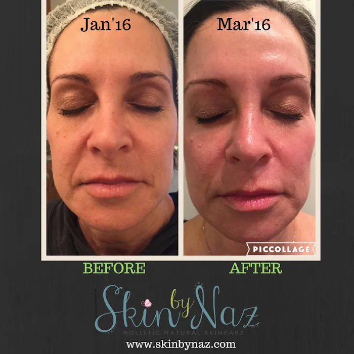 Skin by Naz Picture 8