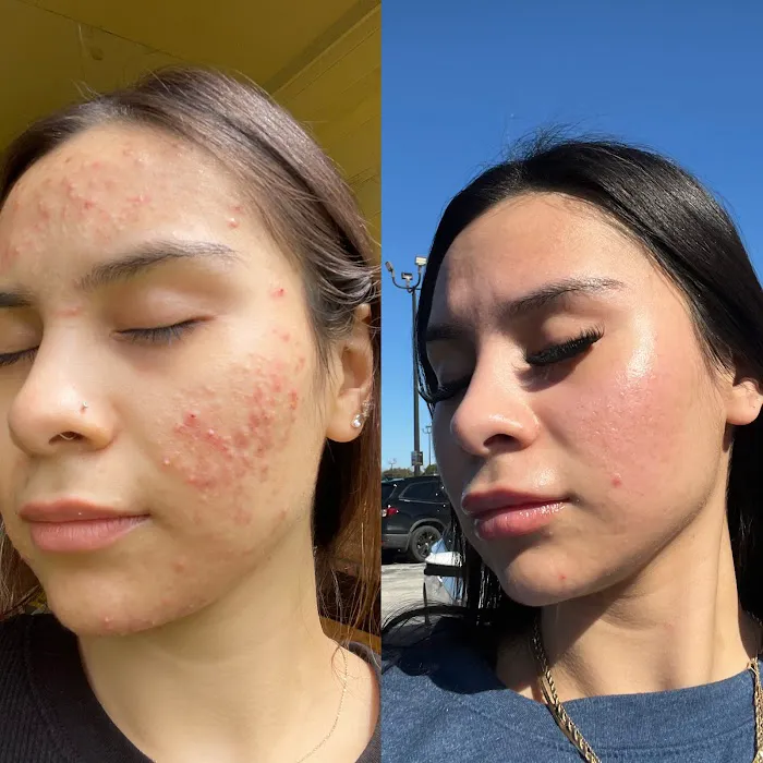 La Skin Rx Picture 1