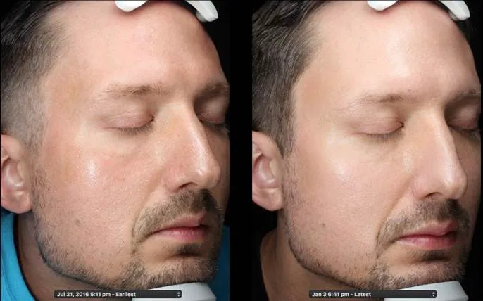 Opal Esthetics Picture 1