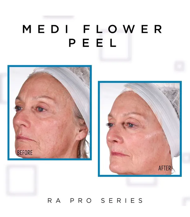 Burleson Aesthetics Picture 10