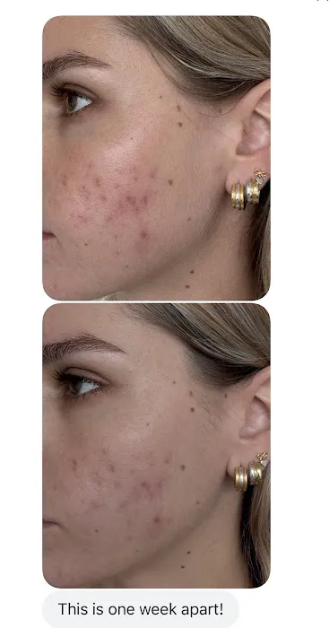 DFW LUXE AESTHETICS Picture 1