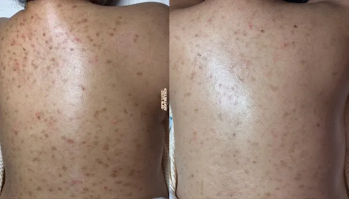 DFW LUXE AESTHETICS Picture 4