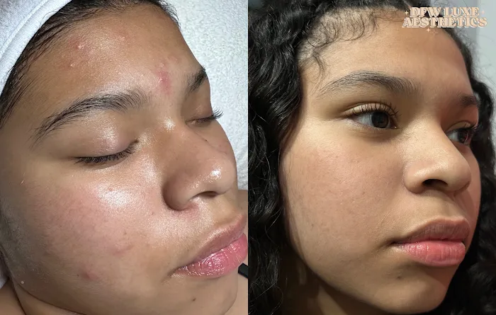 DFW LUXE AESTHETICS Picture 6