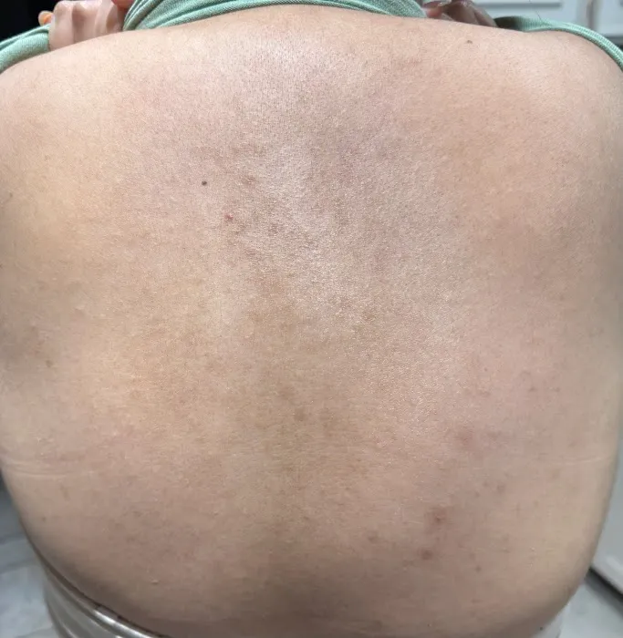 DFW LUXE AESTHETICS Picture 7