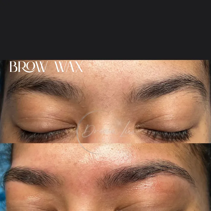 DreamLux Aesthetics Picture 4