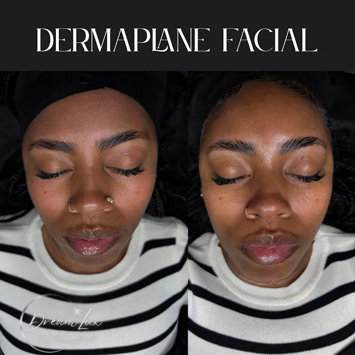 DreamLux Aesthetics Picture 5