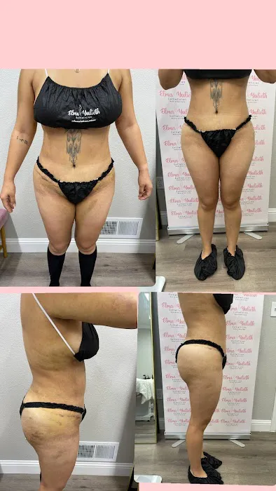 Elma Yulieth Esthetic Skin & Body Care Picture 3