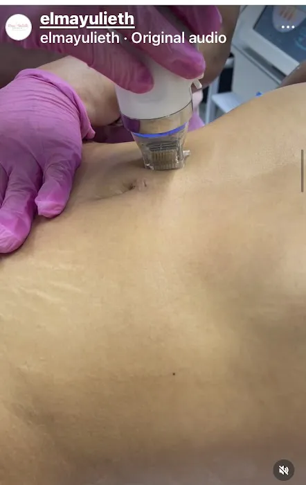 Elma Yulieth Esthetic Skin & Body Care Picture 5