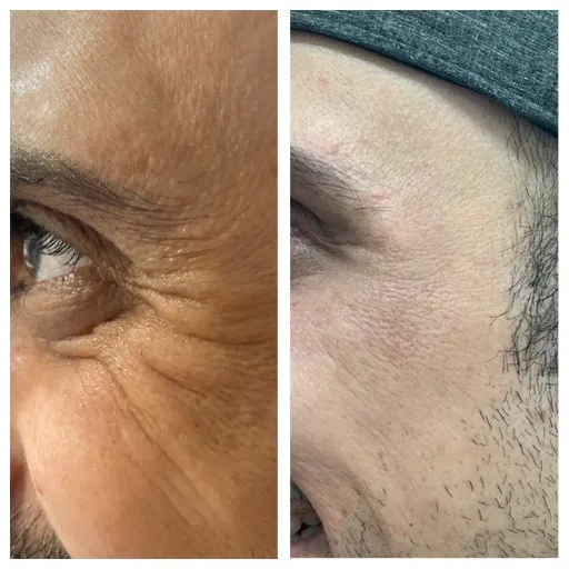 The Facial Room Picture 7