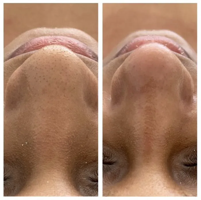 The Facial Room Picture 6