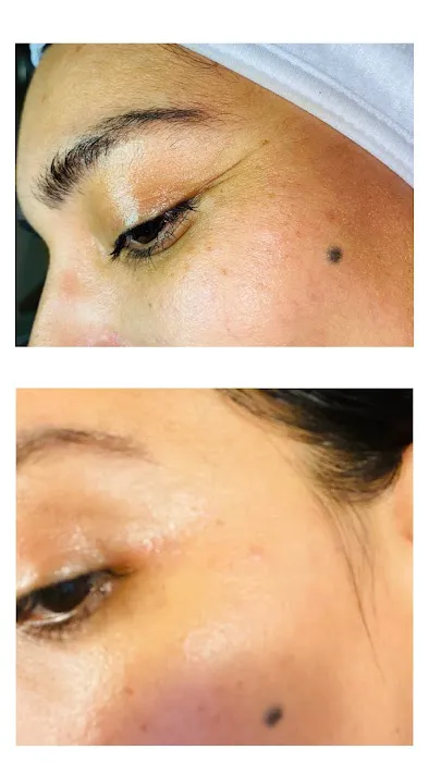 The Facial Room Picture 5