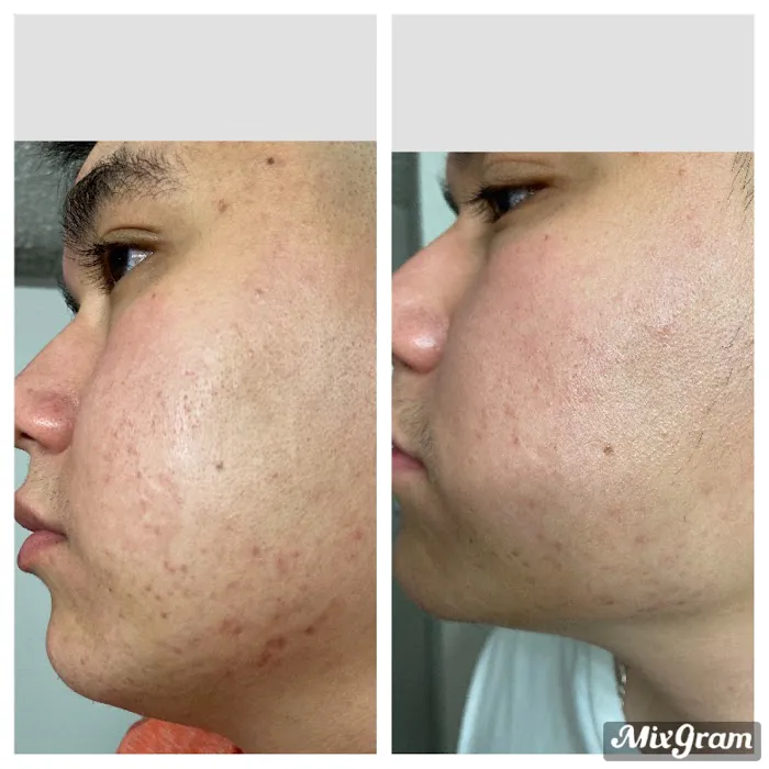 The Facial Room Picture 10